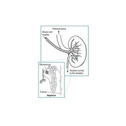 Nephron Diseases