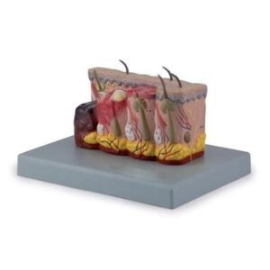 Pathological Model Of Burned Skin