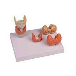Thyroid Diseases – 4 Parts Models